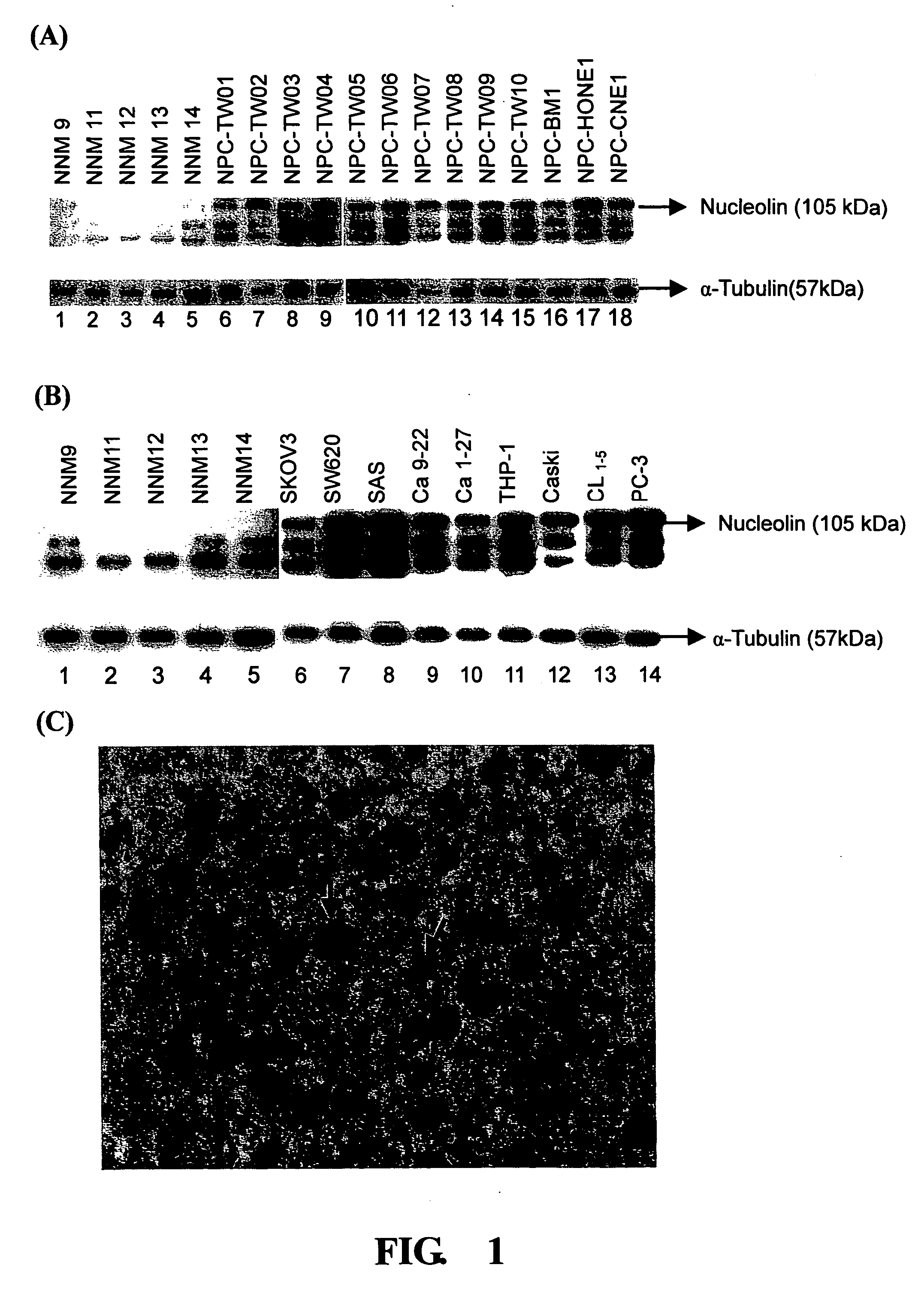 Nucleolin antisense sequence for inhibition of cancer cell proliferation