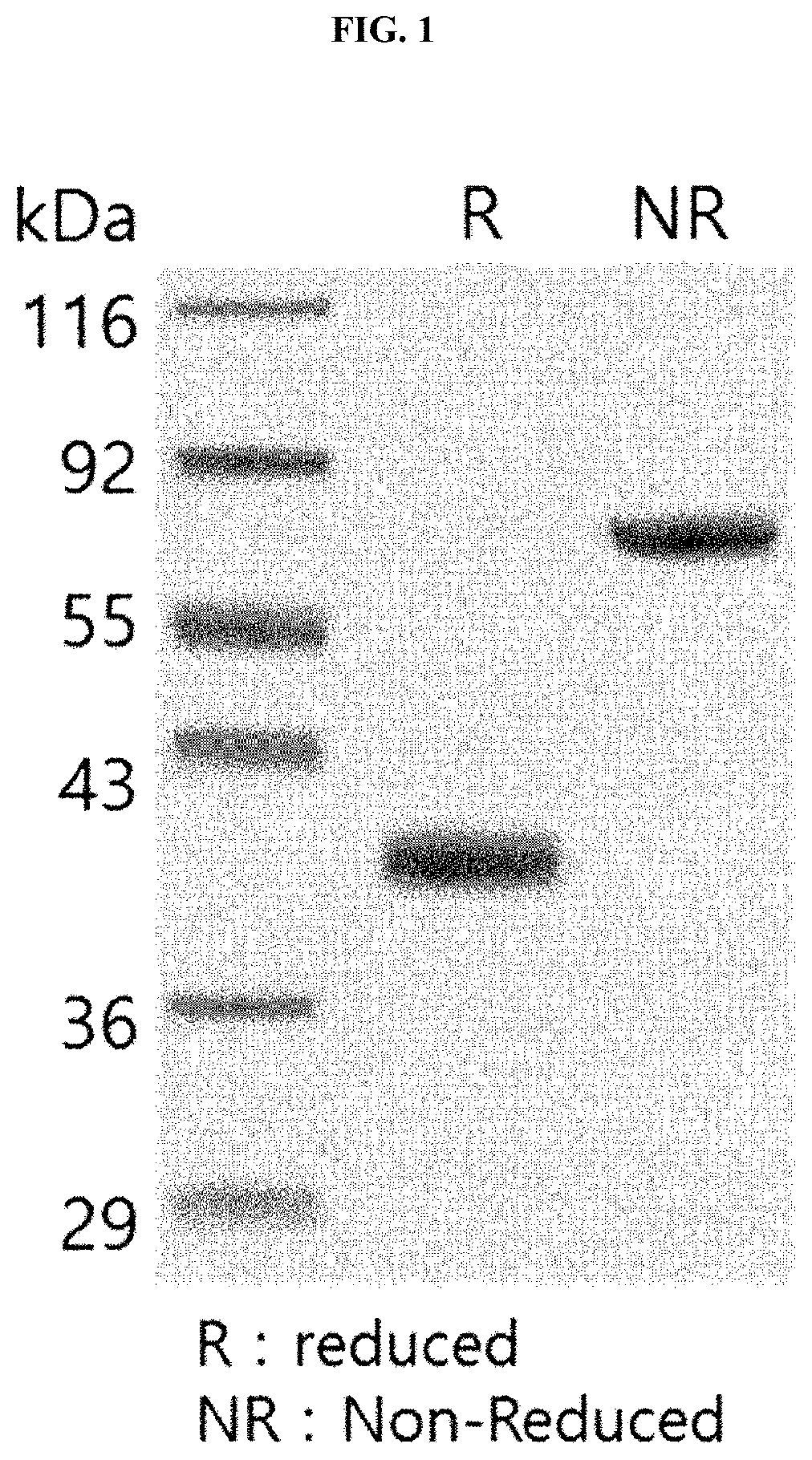 Pharmaceutical composition for preventing or treating cancer, containing cd300c expression inhibitor or activity inhibitor