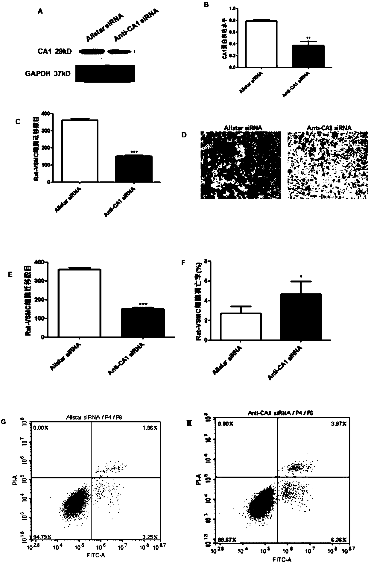 Application of carbonic anhydrase inhibitor to preparation of anti-atherosclerosis drugs