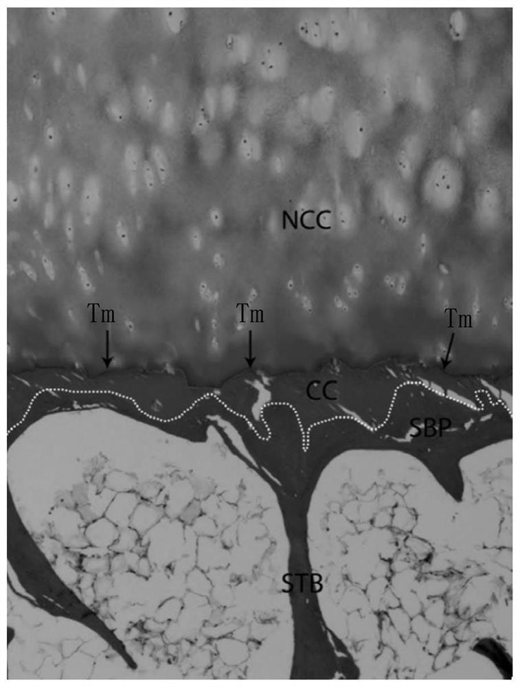 A kind of bionic osteochondral complex and its preparation method