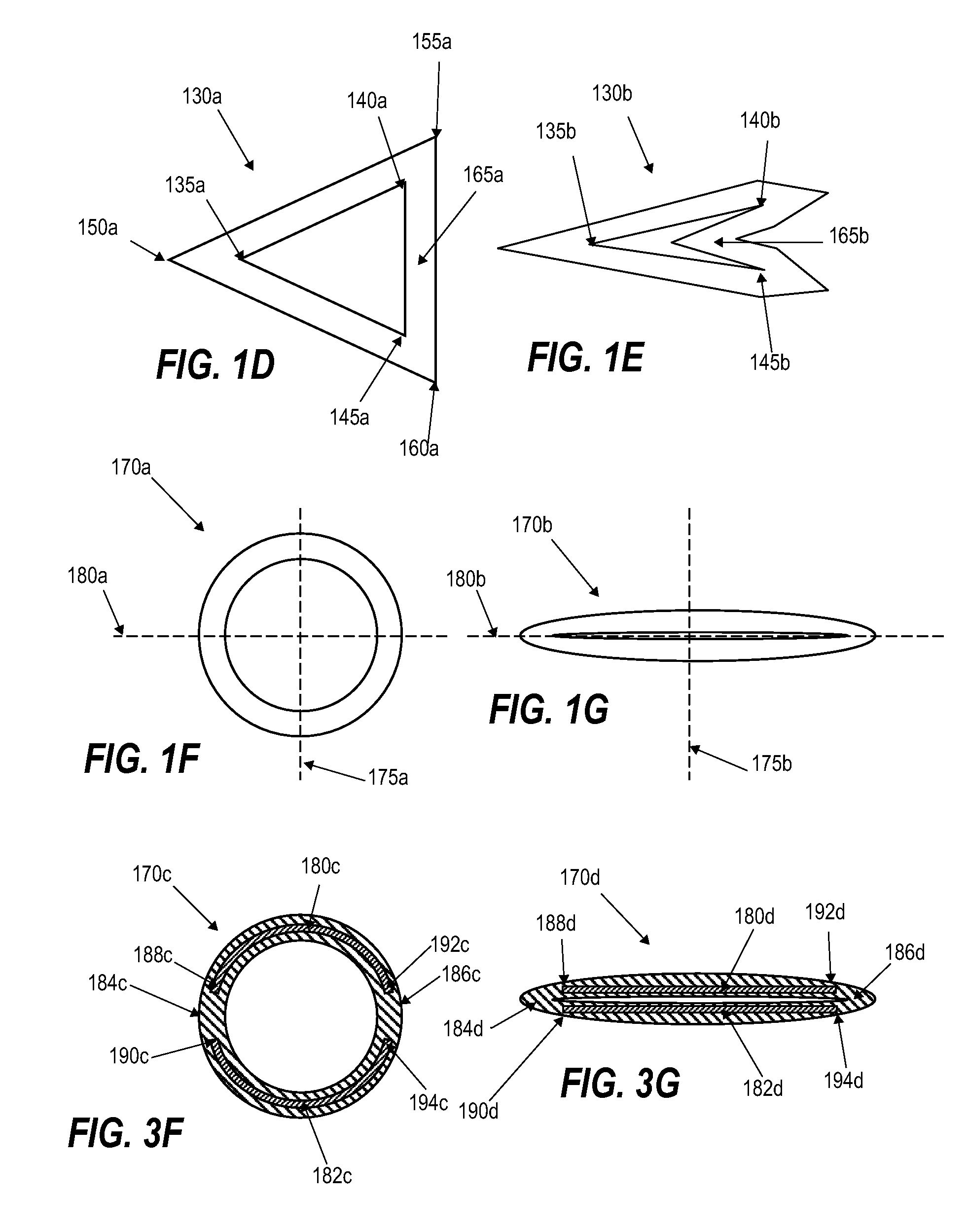Suture-based orthopedic joint devices