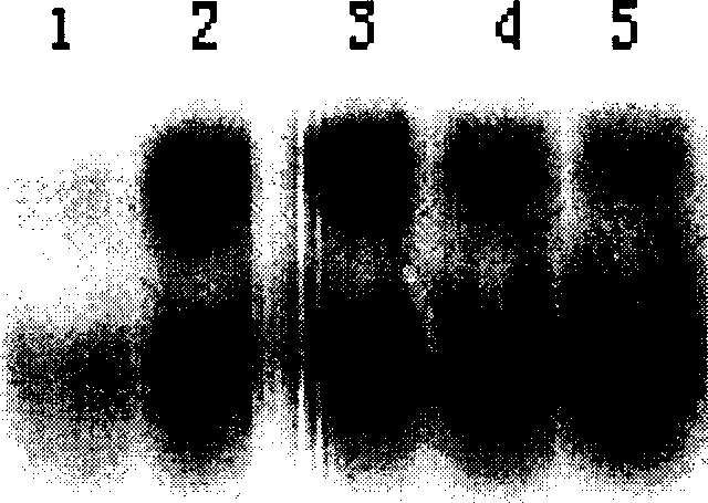 Production and use for taxol and muramic acyl dipeptide conjugate substance of immune reinforcer