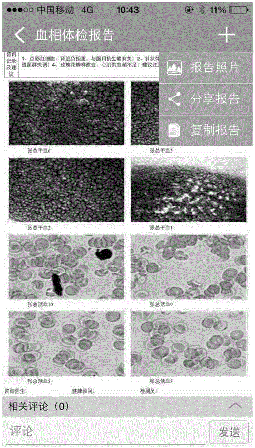 Blood cell morphological analysis internet-of-things detection and diagnosis method and platform