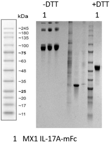 Anti-interleukin 17 (IL-17A) antibody and application thereof