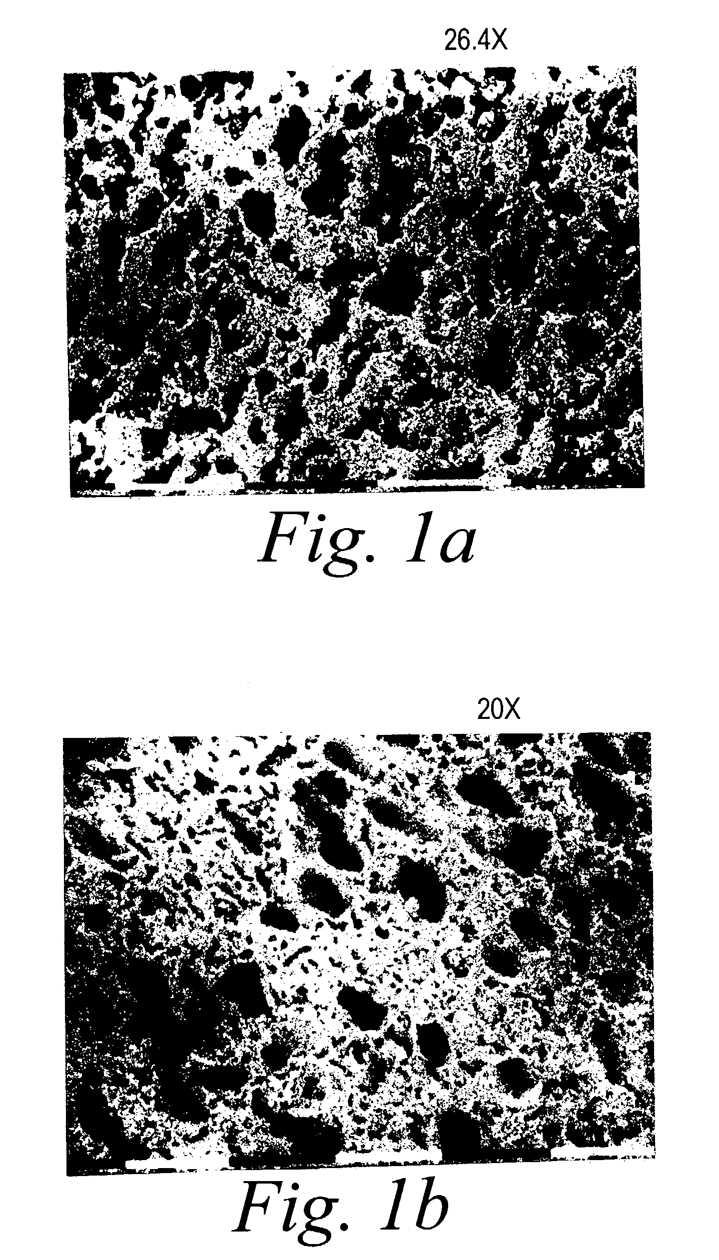 Calcium phosphate bone replacement materials and methods of use thereof
