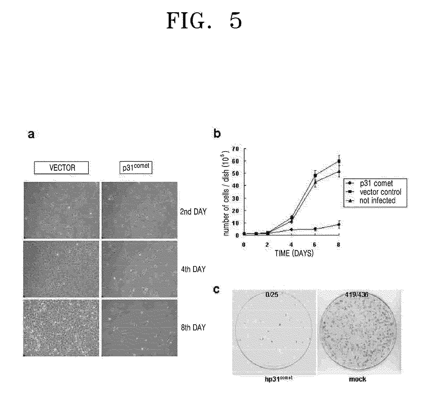 PHARMACEUTICAL COMPOSITION FOR TREATING MALIGNANT TUMORS CONTAINING HUMAN p31 GENES