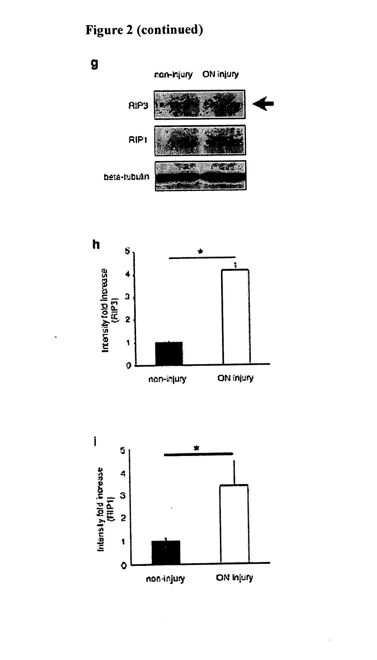 Methods and compositions for preserving retinal ganglion cells