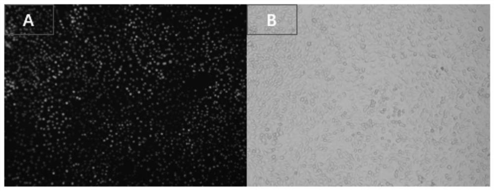 A kind of rabies virus that marks the neural network structure of the whole brain area, its preparation and application