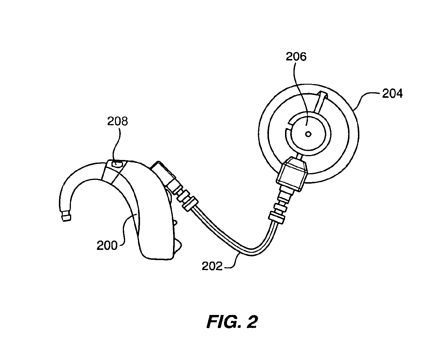 Implantable hearing aid transducer with actuator interface