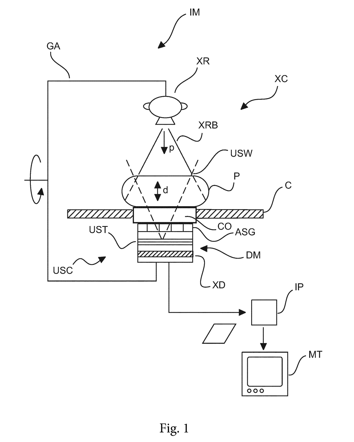 Ultrasound compatible x-ray Anti-scatter grid