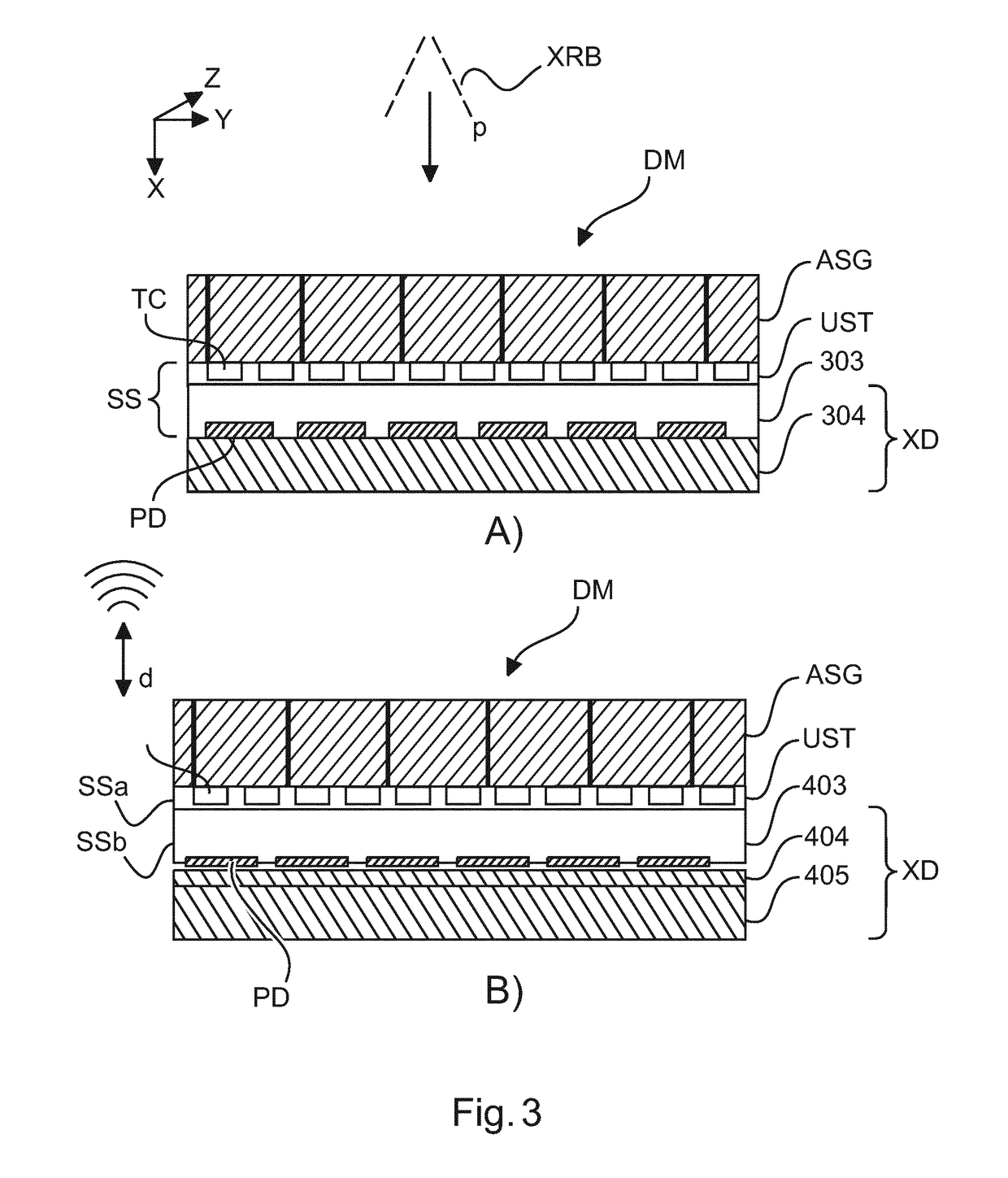 Ultrasound compatible x-ray Anti-scatter grid