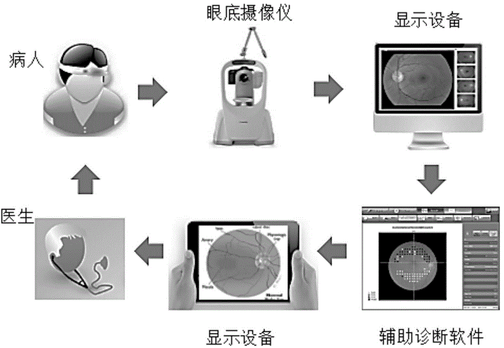 Morphological segmentation-based eye fundus image lesion detection method