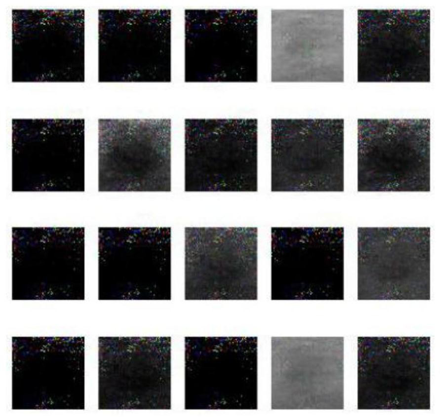 Method for generating medical ultrasonic image data based on adversarial network