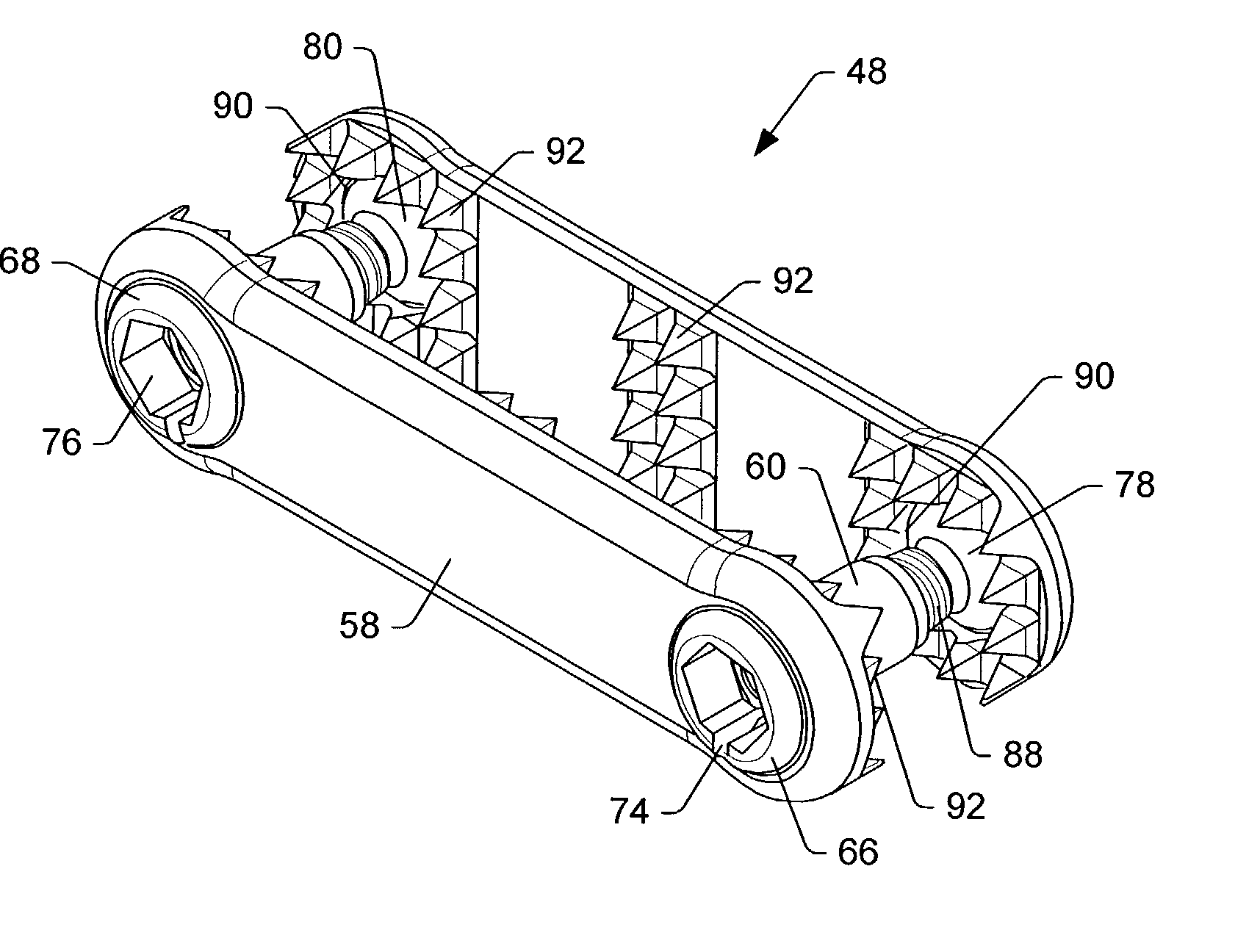 Spinal stabilization system and method