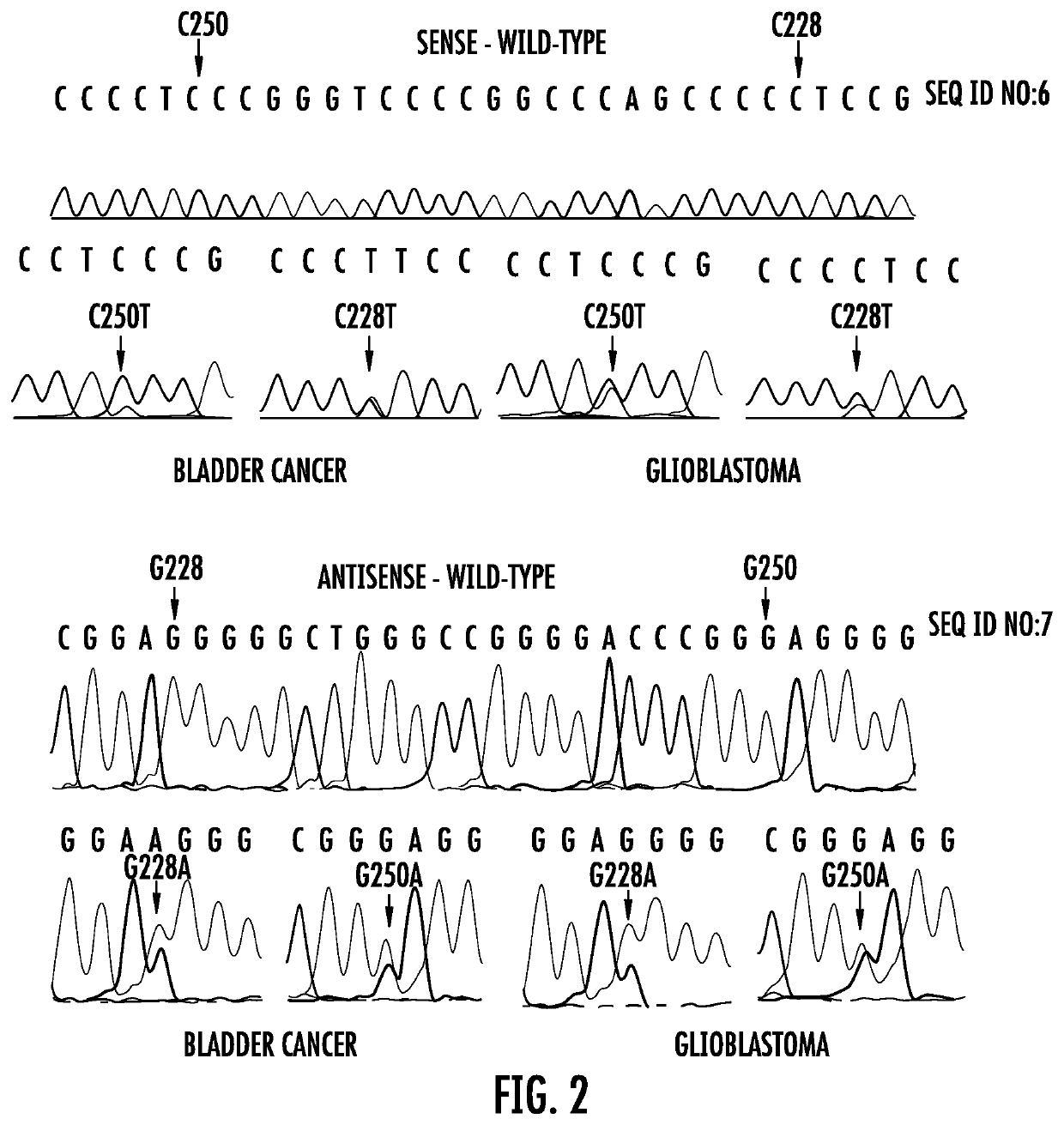 TERT promoter mutations in cancer