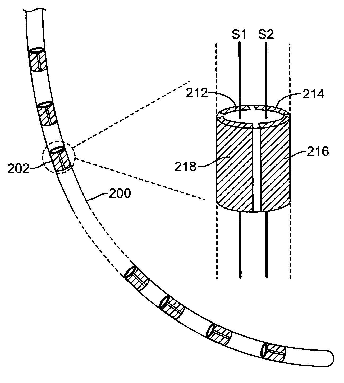 Methods and apparatus for leads for implantable devices