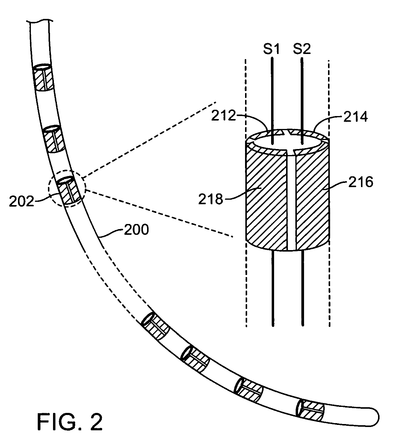 Methods and apparatus for leads for implantable devices