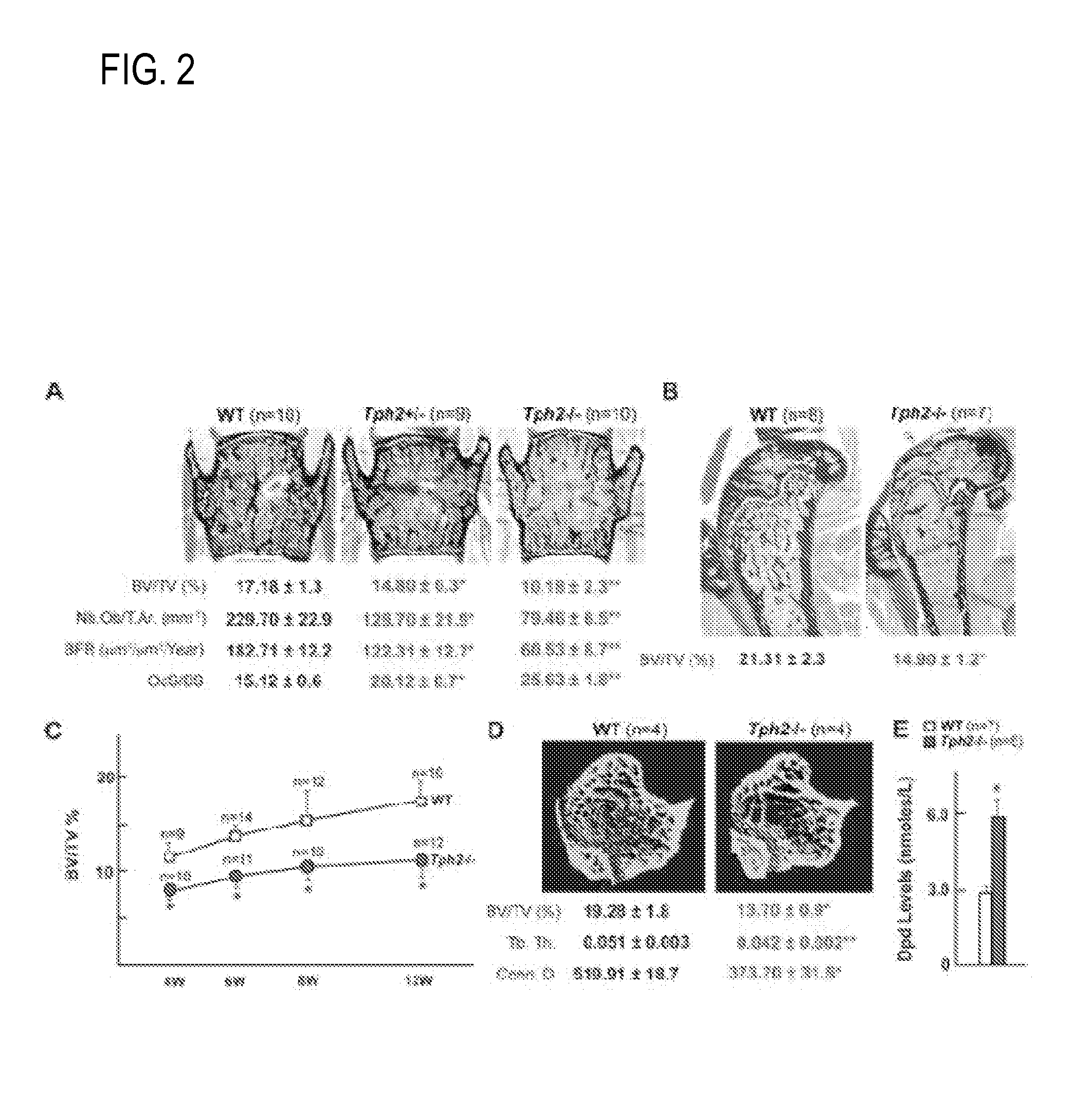 Methods of Suppressing Appetite by the Administration of Antagonists of the Serotonin HTR1a or HTR2b Receptors or Inhibitors of TPH2