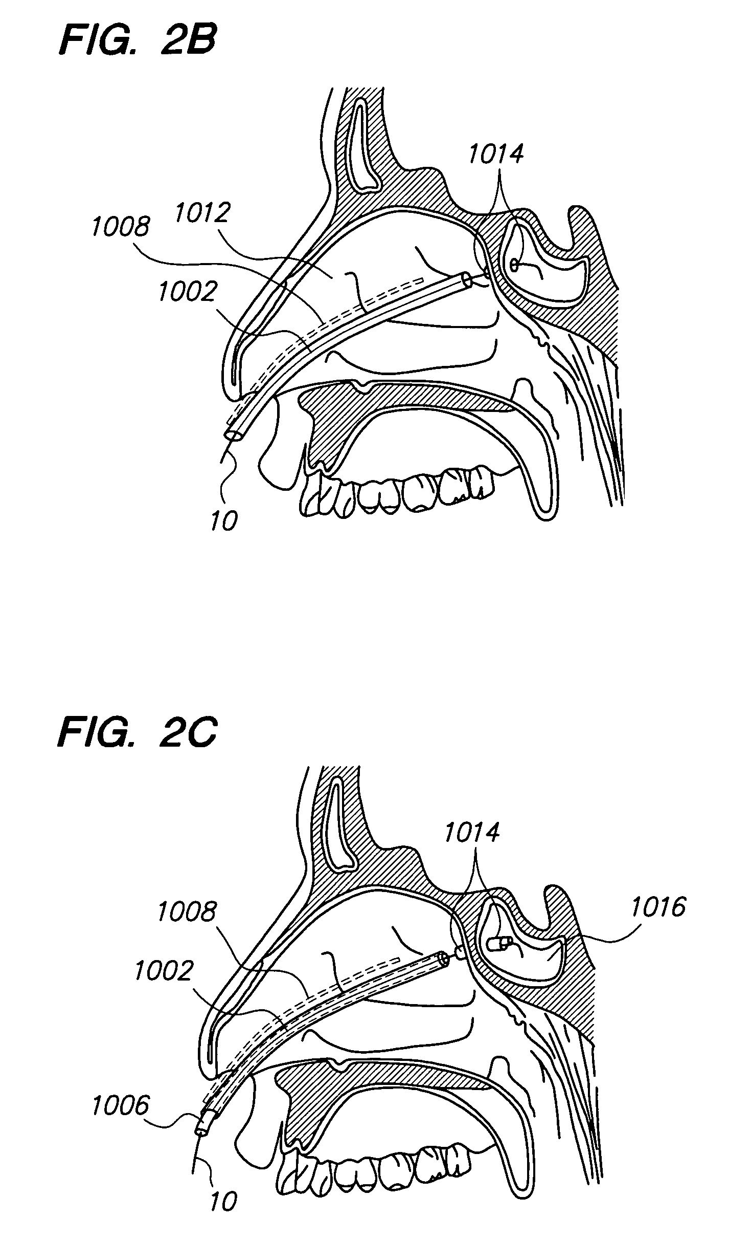 Methods and devices for facilitating visualization in a surgical environment