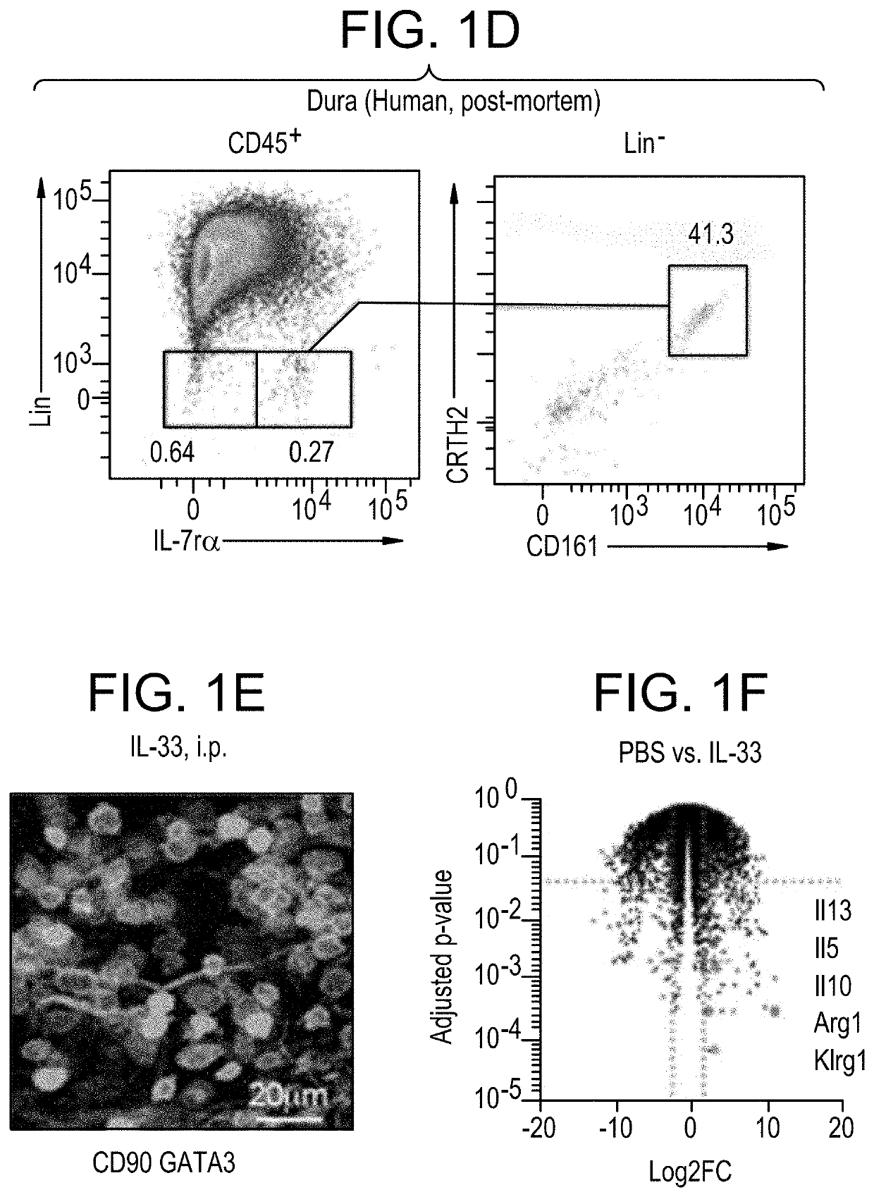 Suppression of Microglial Activation with Innate Lymphoid Cells