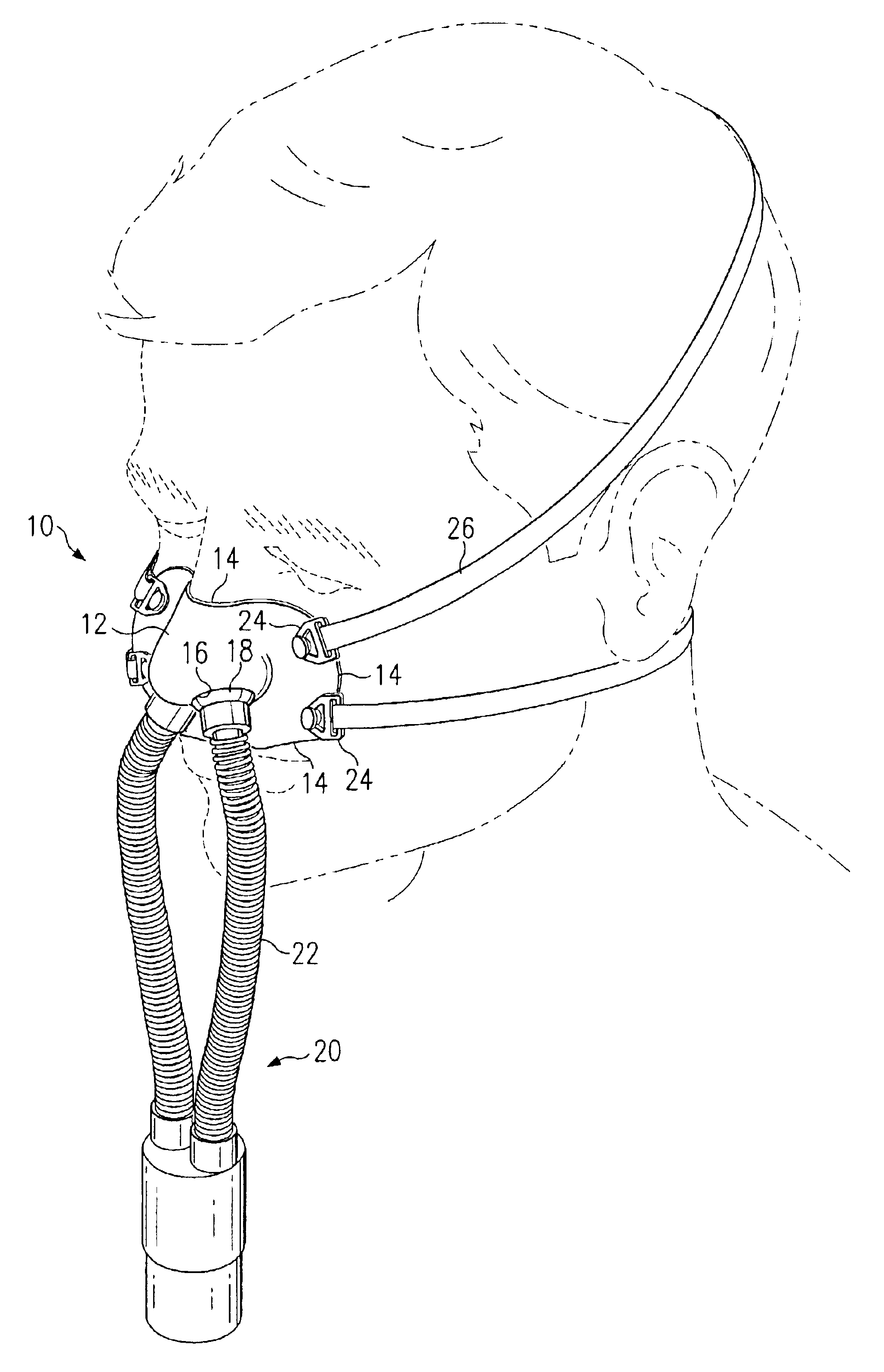 Custom fitted mask and method of forming same