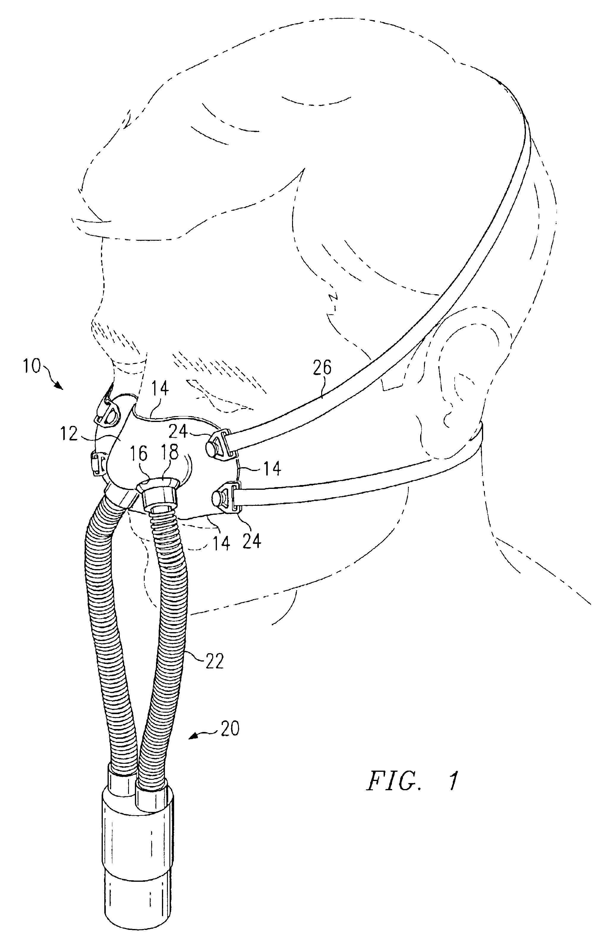 Custom fitted mask and method of forming same