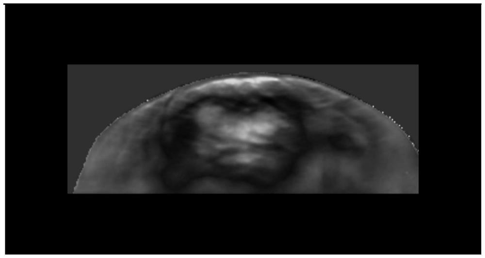 Method and device for performing tumor diagnosis by using ultrasonic image fusion data