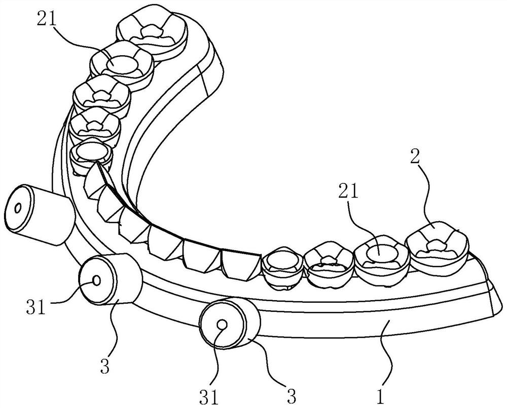 Instant load-bearing transition denture, combined device and digital preparation method