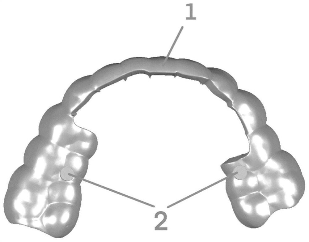 Multifunctional resin guide plate for assisting in bonding periodontal splint and preparation method of multifunctional resin guide plate