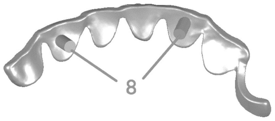 Multifunctional resin guide plate for assisting in bonding periodontal splint and preparation method of multifunctional resin guide plate