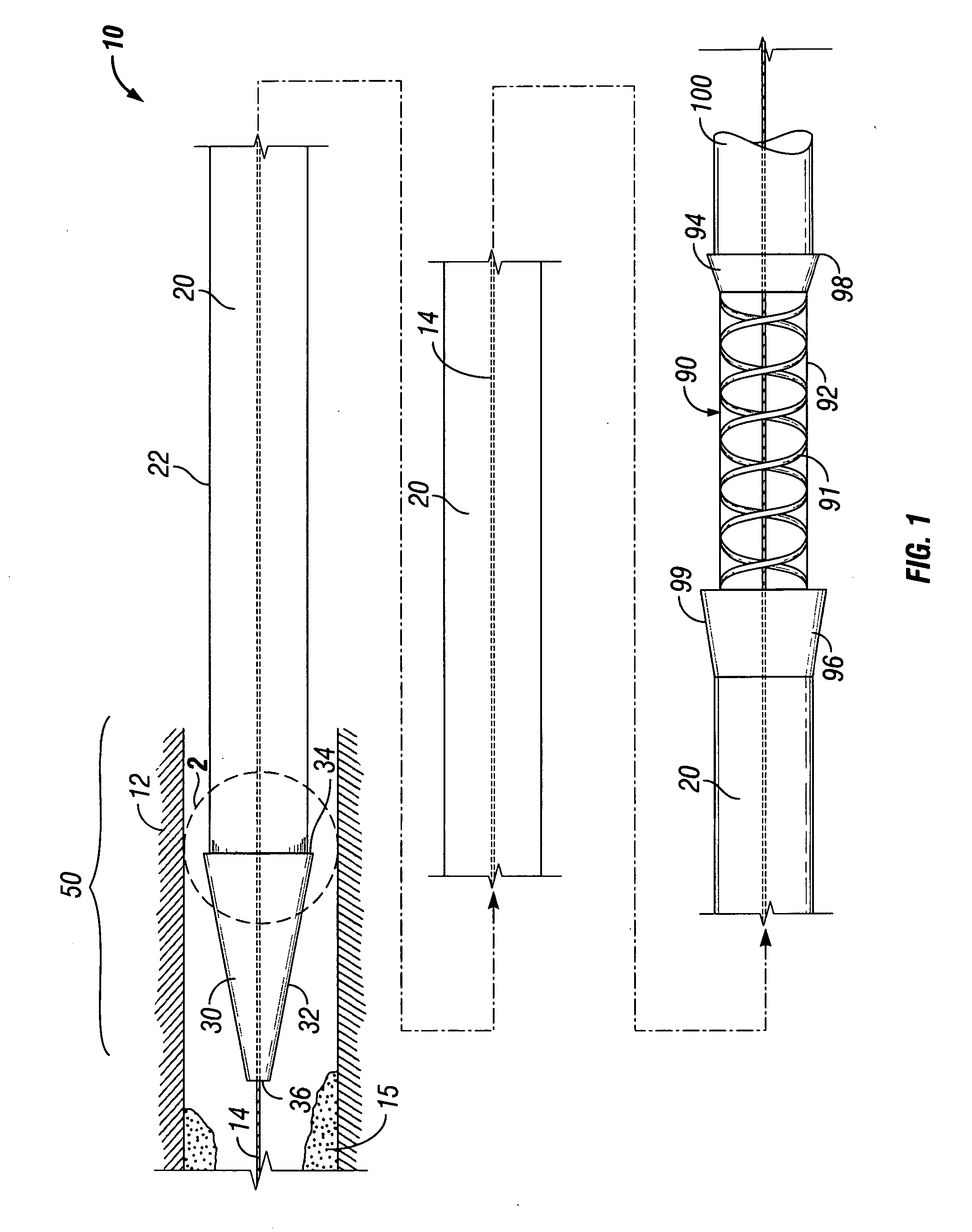 Esophageal dilation and stent delivery system and method of use