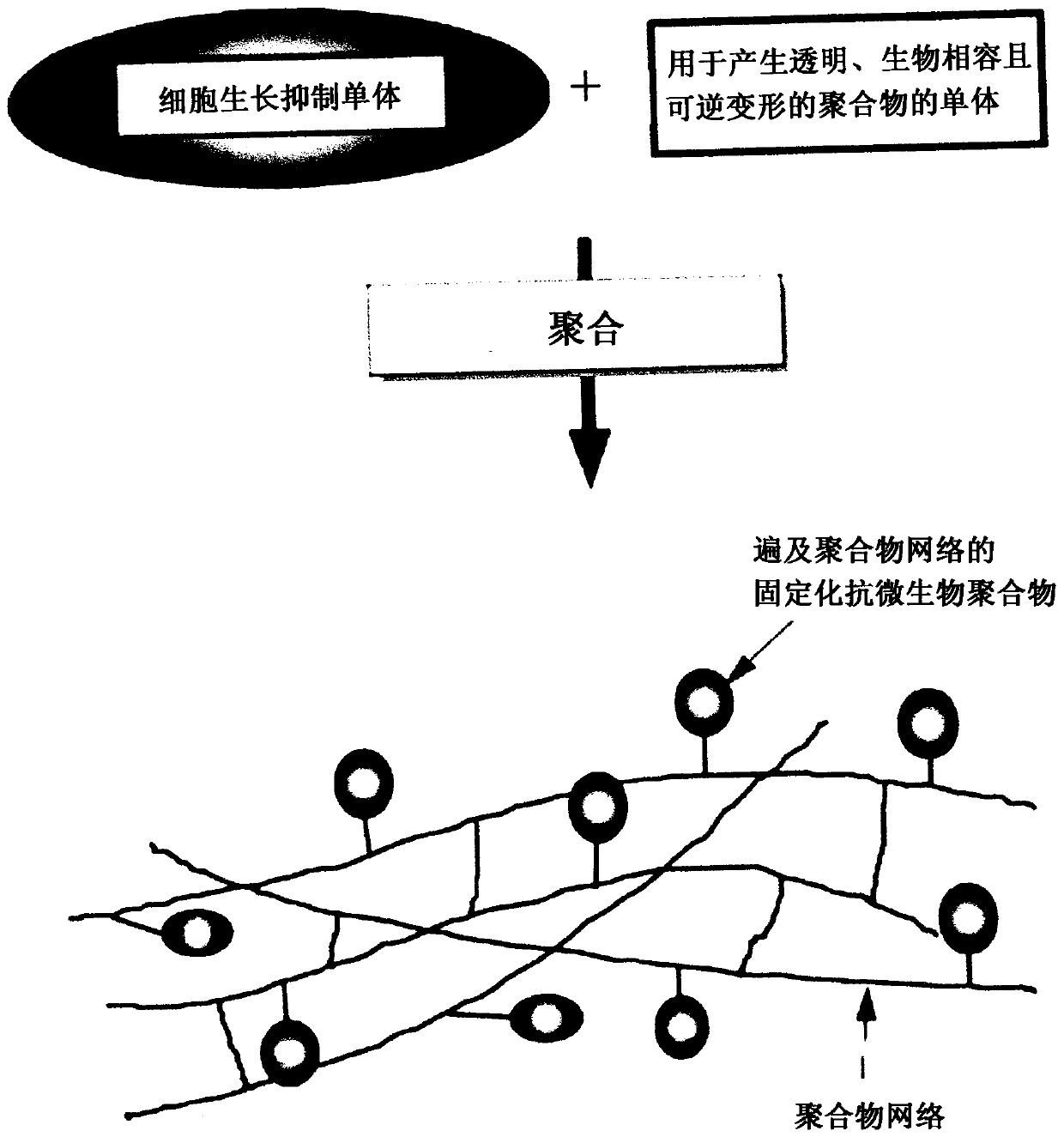 Cell growth inhibiting copolymer for use in ophthalmic implants