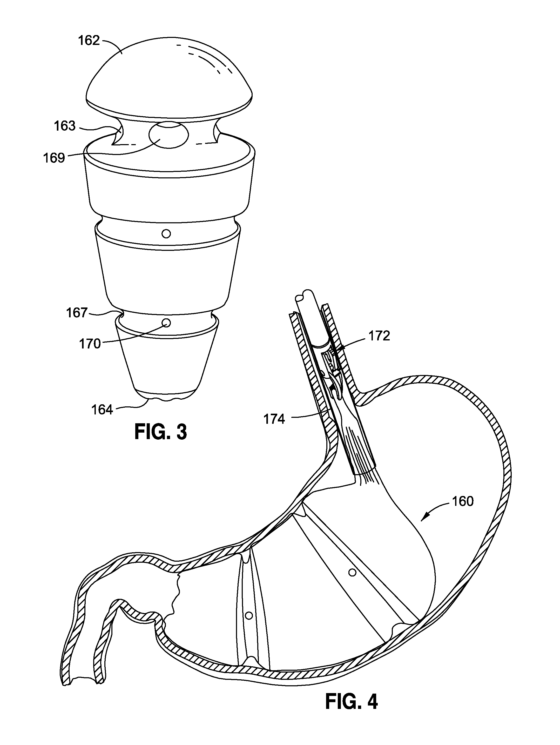Space-filling intragastric implants with fluid flow