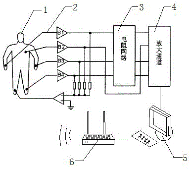Common-mode voltage negative feedback electrocardiograph based on computer control