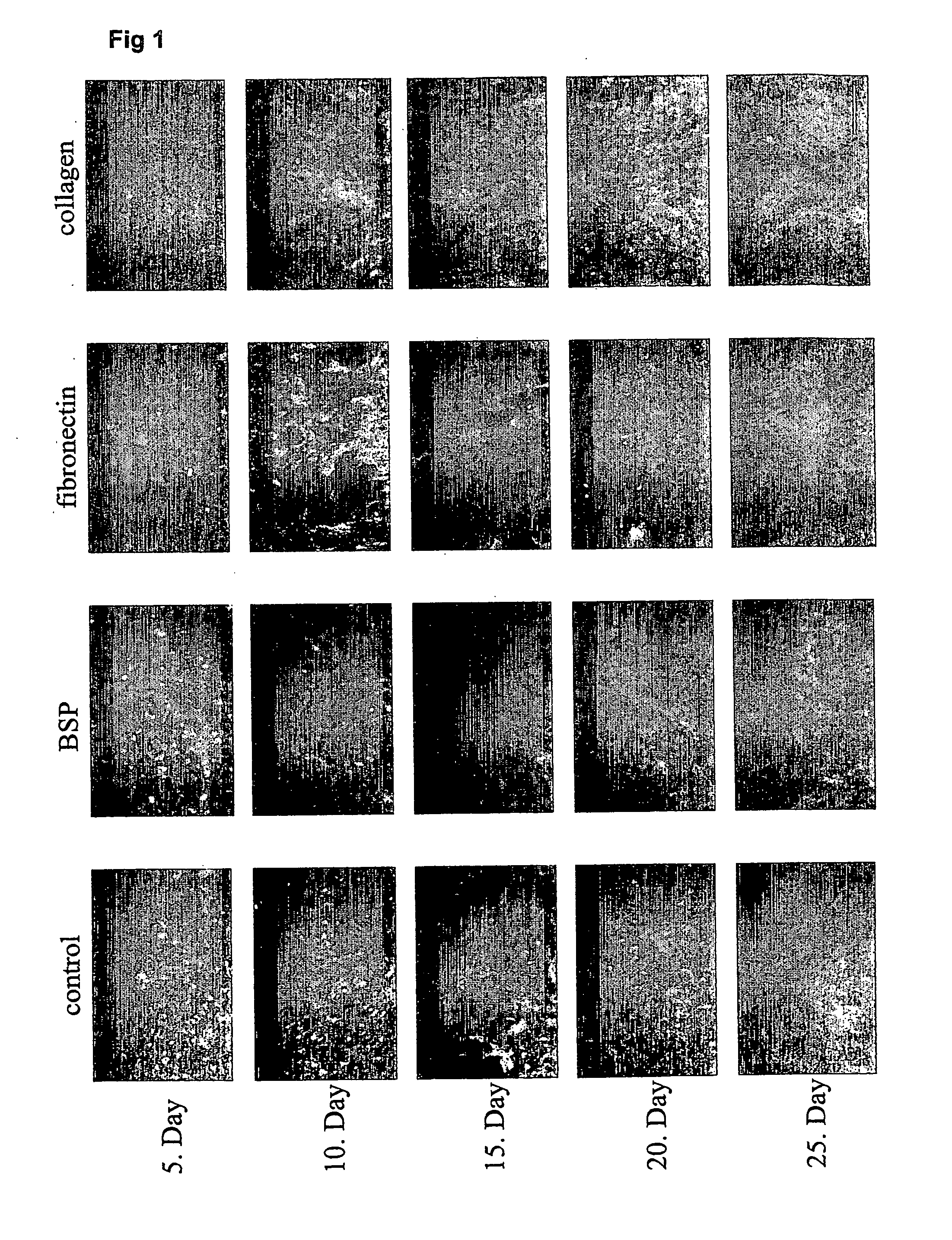 Osteogenic Implant Matrices and Endosseous Tooth Implants with Improved Osteointegration Properties