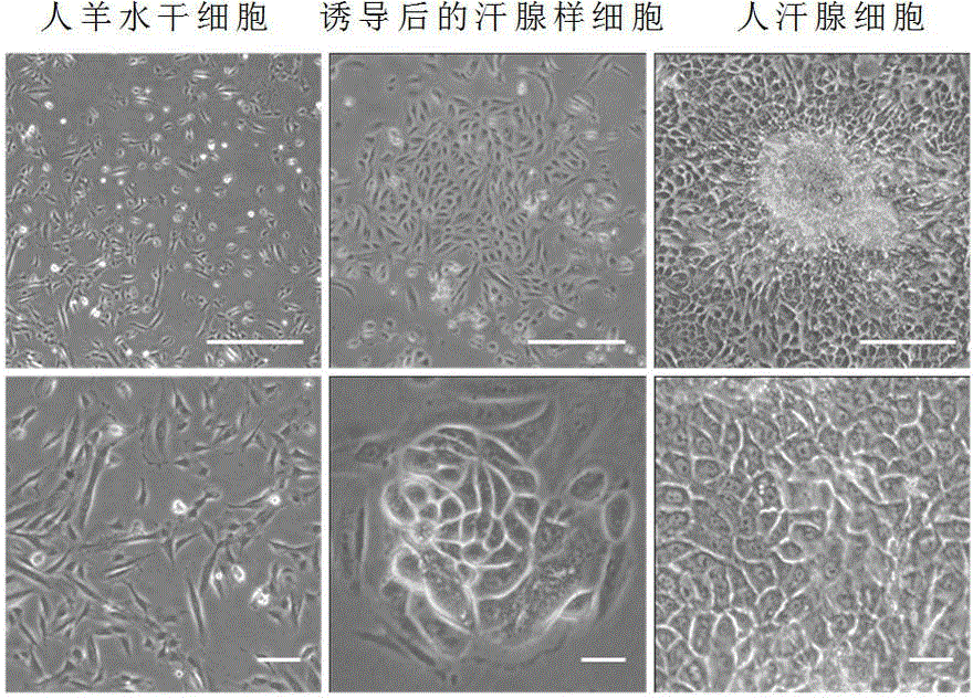 Eccrine sweat gland cell induction medium and application thereof
