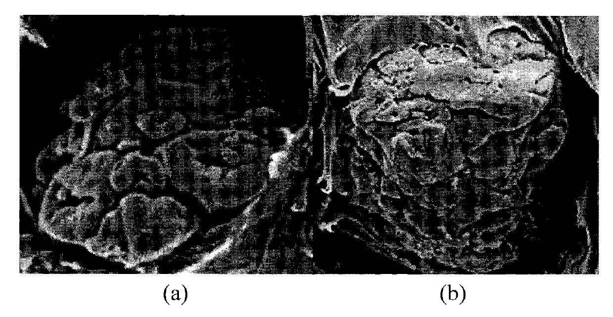 Pre-modified PVC (Polyvinyl Chloride) resin and modified PVC (Polyvinyl Chloride) resin as well as preparation method thereof and application thereof