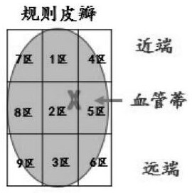 Nursing monitoring system and method, management system and storage medium after flap transplantation