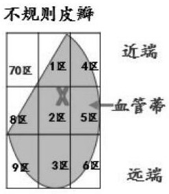 Nursing monitoring system and method, management system and storage medium after flap transplantation