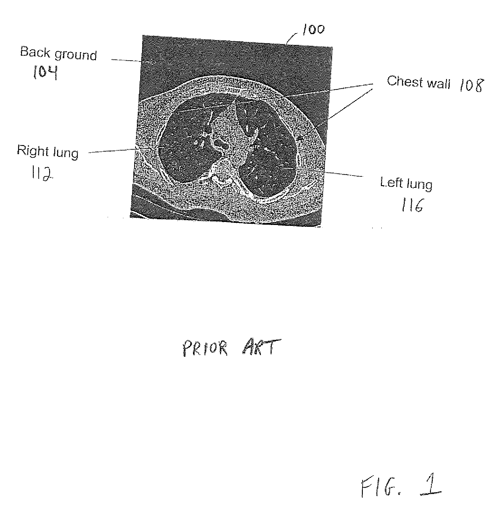 Method and System for Automatic Lung Segmentation