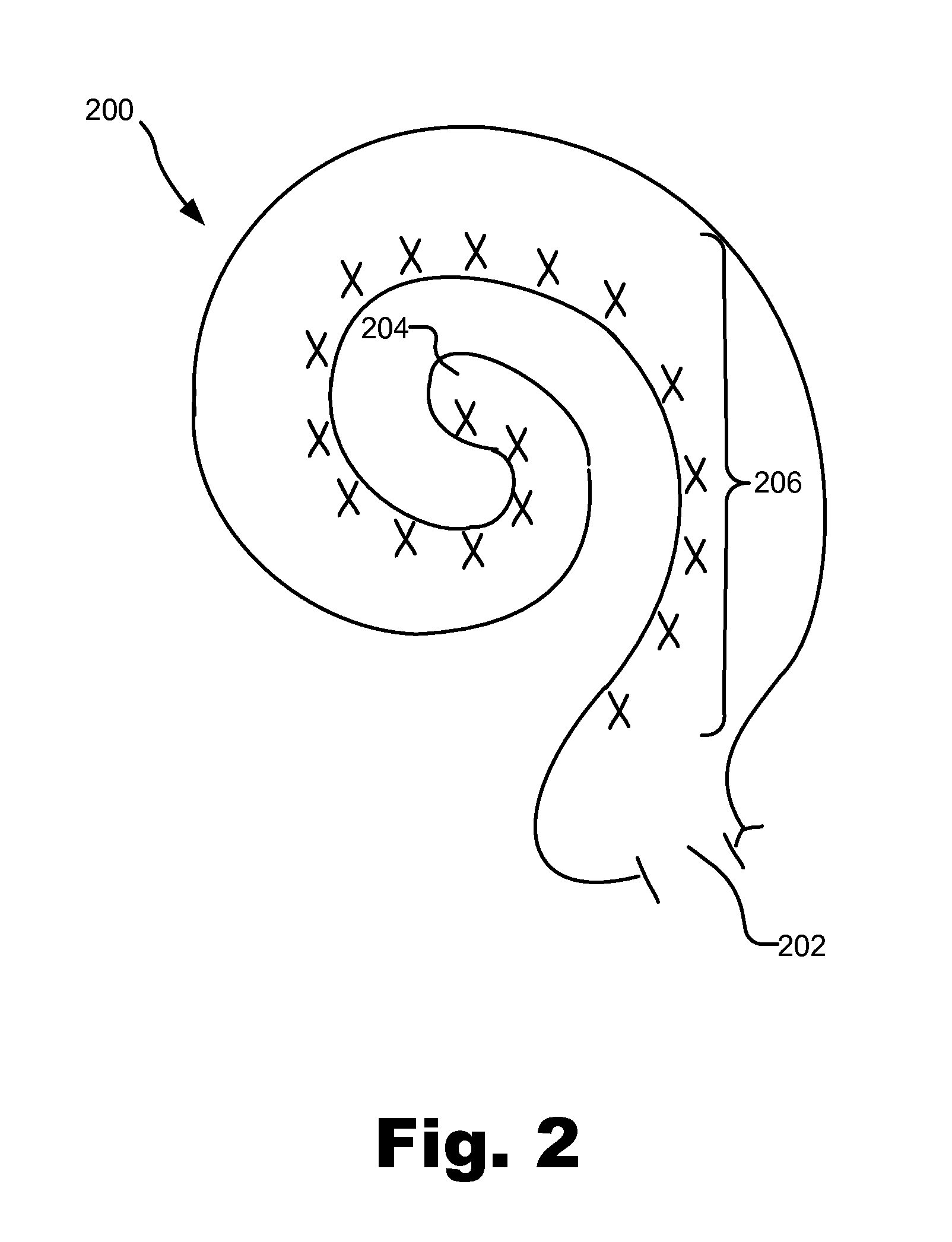 Systems and methods for positioning an intraneural electrode array in an auditory nerve