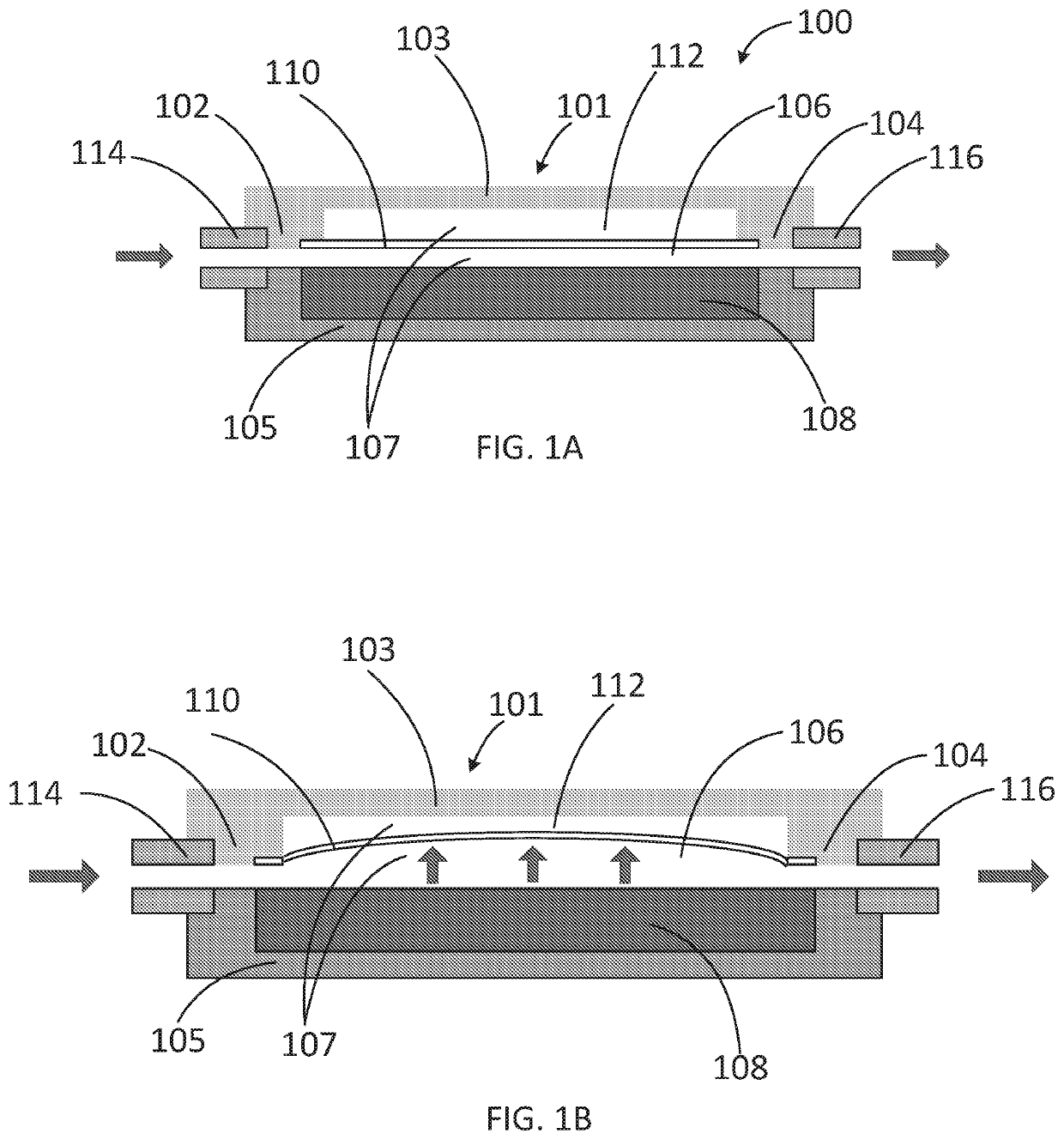 Apparatus for treating excess intraocular fluid having an elastic membrane