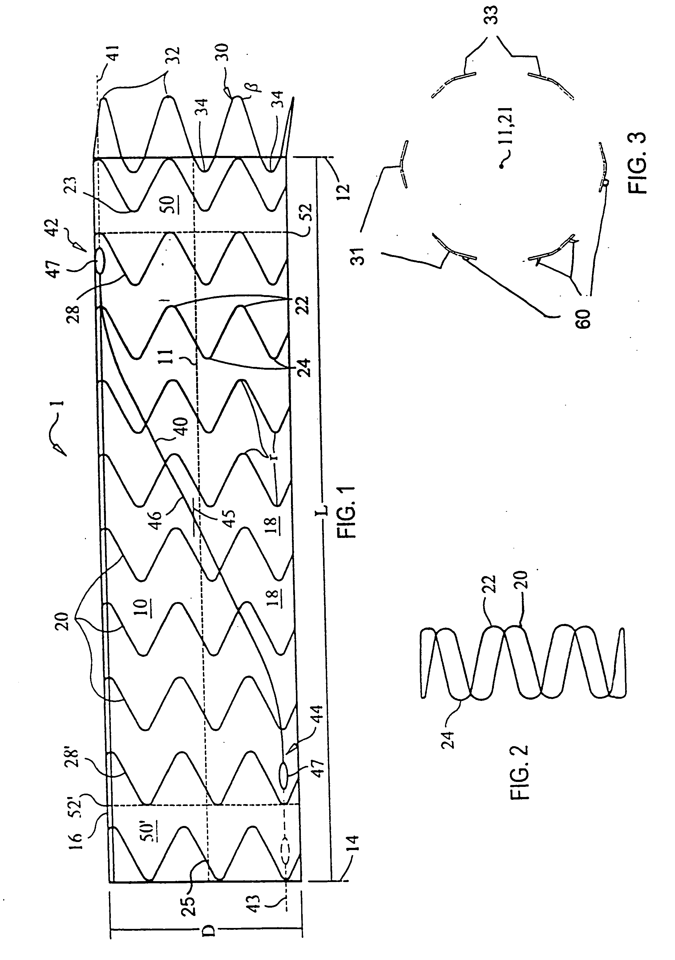 Self-aligning stent graft delivery system, kit, and method