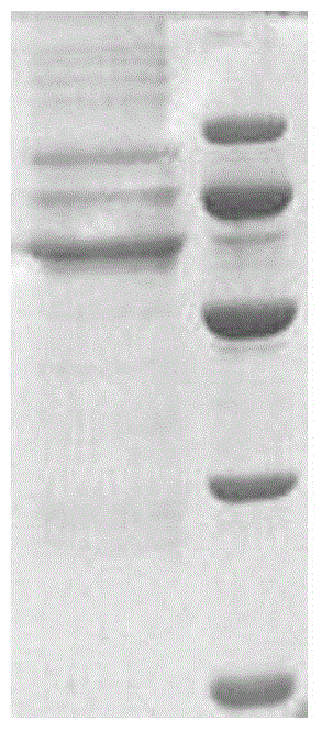 Recombinant adeno-associated virus-NADH dehydrogenase sigmasubunit 4 gene total length for treating Leber hereditary optic neuropathy and medicament