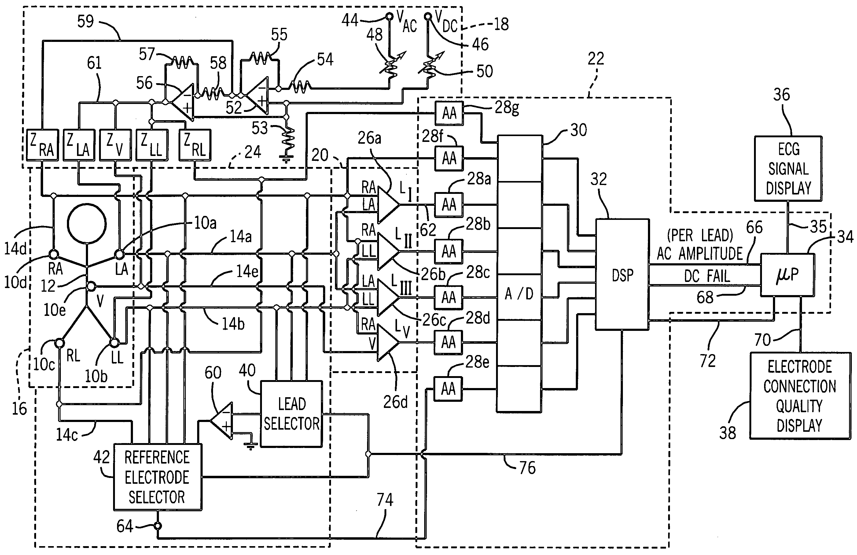 Impedance measurement apparatus for assessment of biomedical electrode interface quality