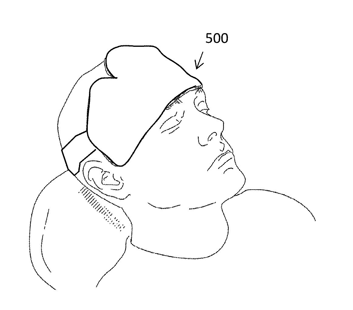 Tetherless wearable thermal devices and methods of using them for treatment of sleeping and neurological disorders