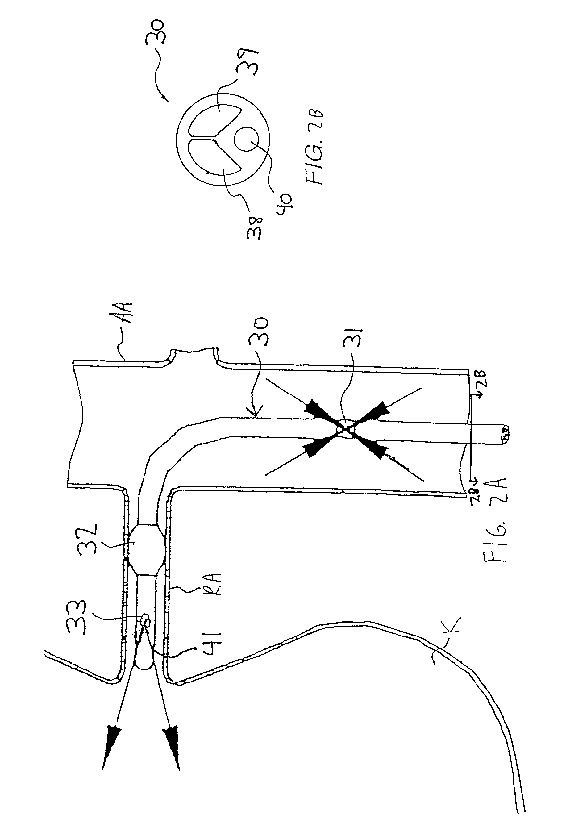 Apparatus and methods for treating congestive heart disease