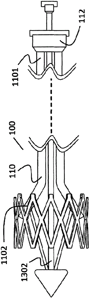 A Novel Device Release Device for Implantation