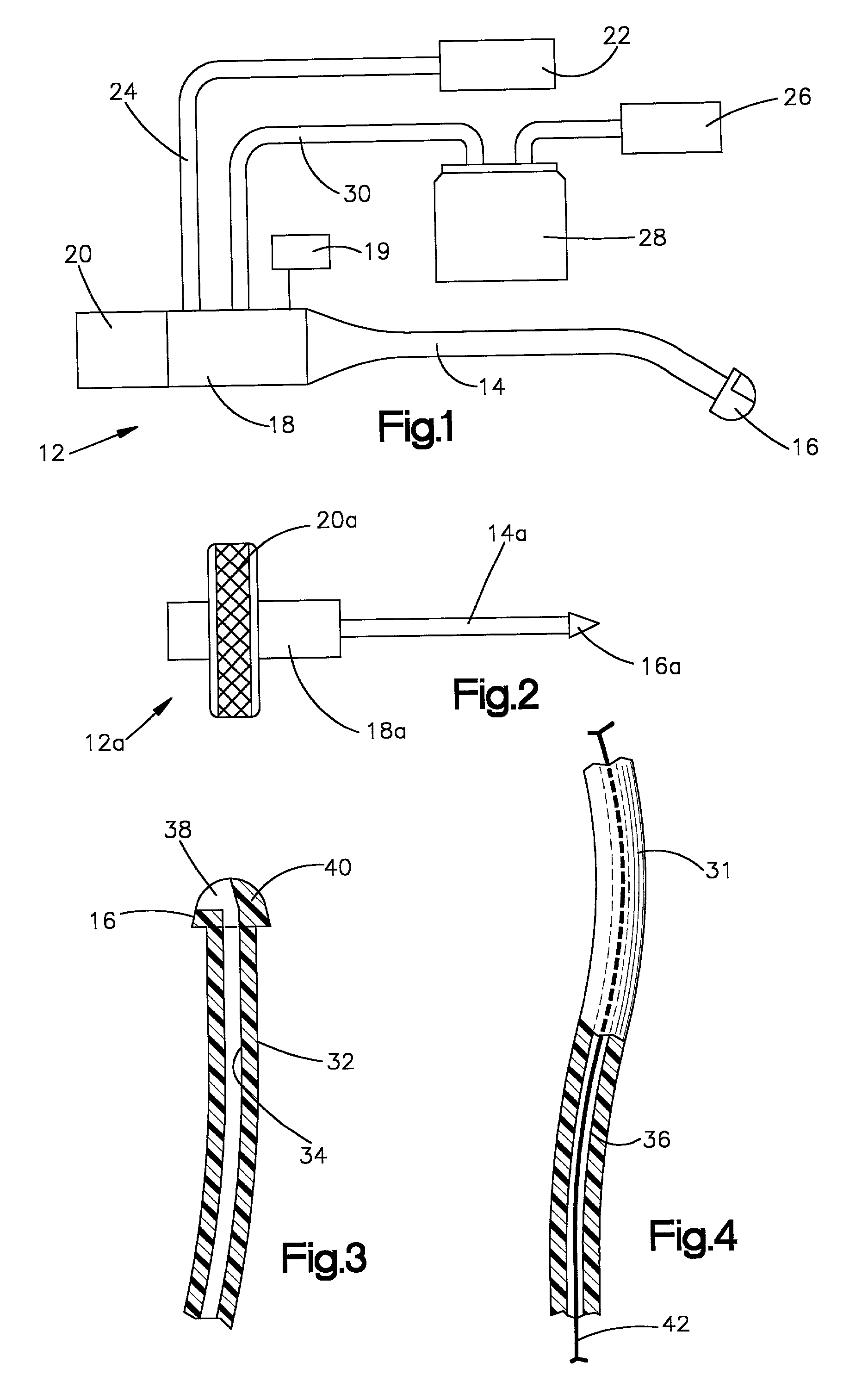 Apparatus and method for tissue removal