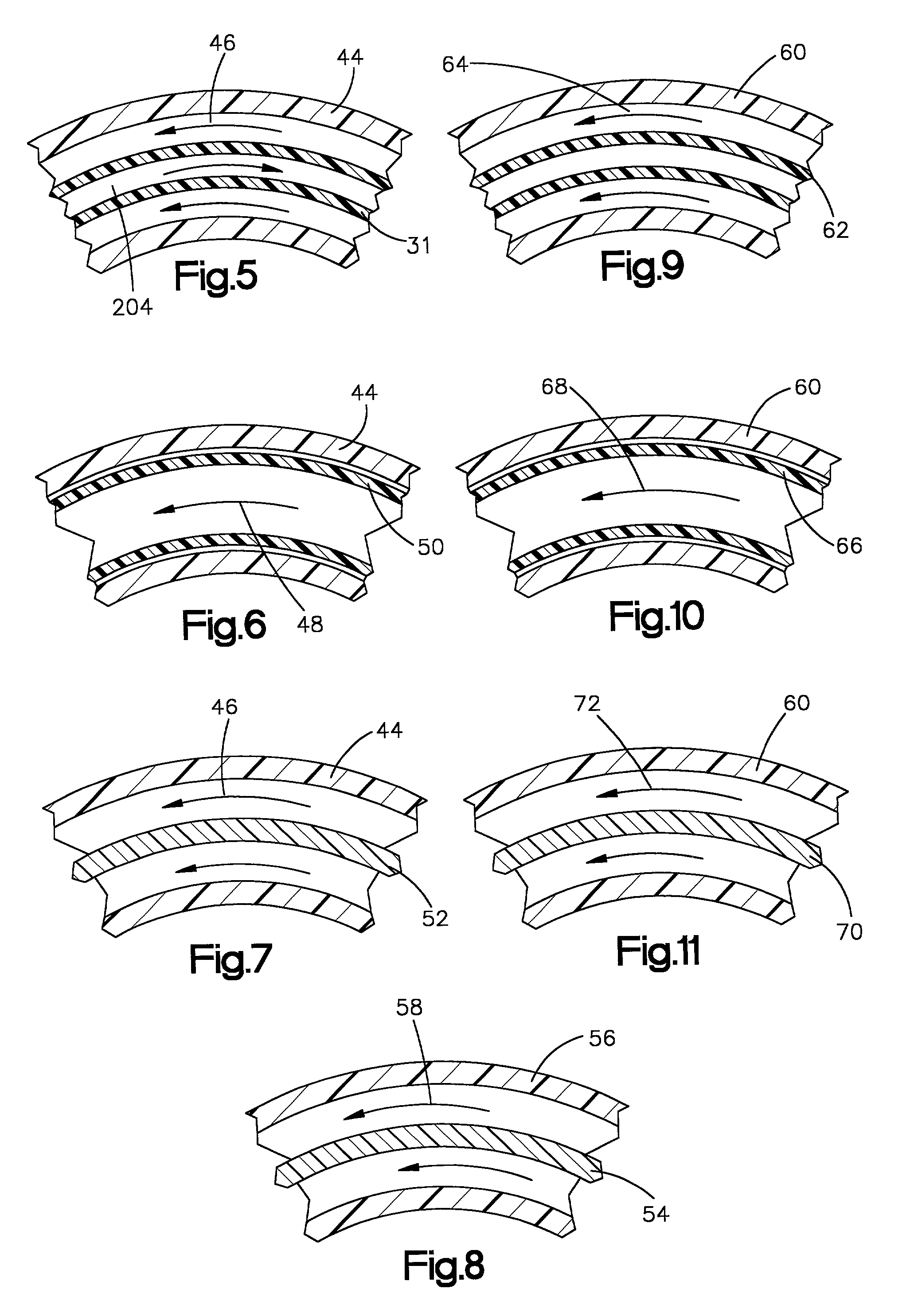 Apparatus and method for tissue removal